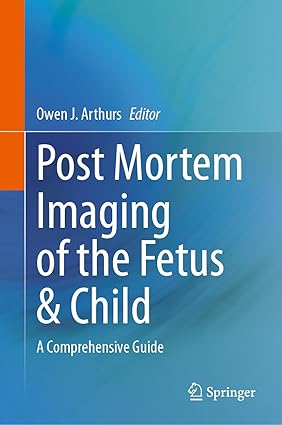 Post Mortem Imaging of the Fetus & Child: A Comprehensive Guide-Wow! eBook