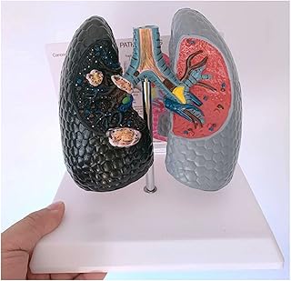 Human Lung Model Respiratory Lung and Bronchial Teaching Aids Normal and Pathological Lungs Versus Lung Anatomical Models