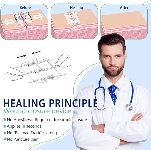 Miniatura 4 de Cierres de laceración de emergencia, bandas de mariposa con suturas con cremallera (2 juegos) - Reparación de laceración sin puntadas, la vida