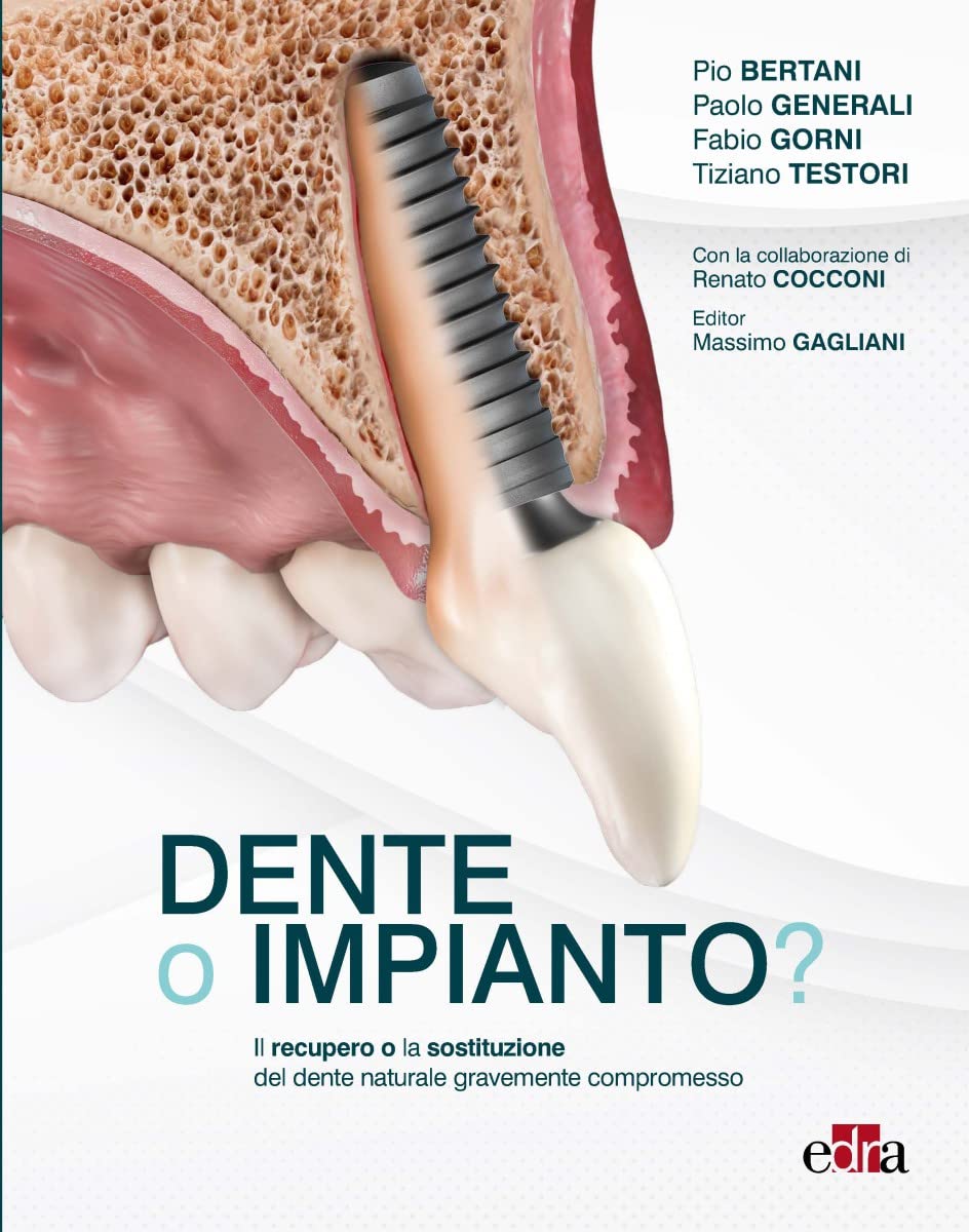 Dente O Impianto? Il Recupero O La Sostituzione Del Dente Naturale Gravemente Compromesso - 4