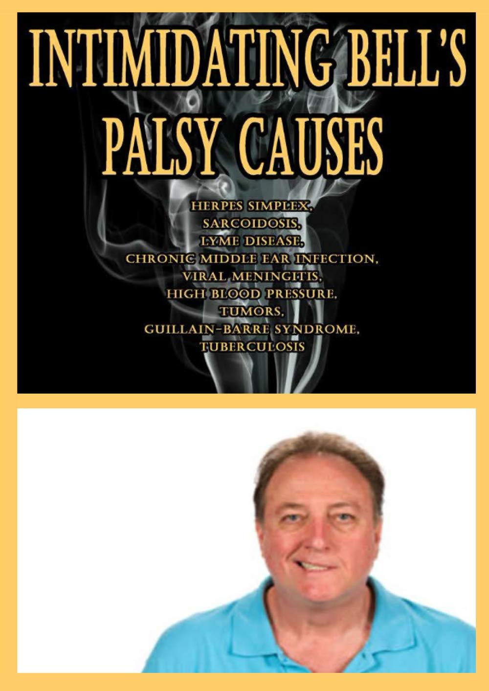 Buy Intimidating Bell’s Palsy Causes Herpes Simplex, Sarcoidosis, Lyme Disease, Chronic Middle