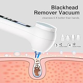 UMICKOO Face Scrubber Exfoliator with LCD Screen,Rechargeable Facial Cleansing Brush IPX7 Waterproof 3 in 1 Blackhead Remover Vacuum for Exfoliating,Massaging and Deep Pore Cleansing
