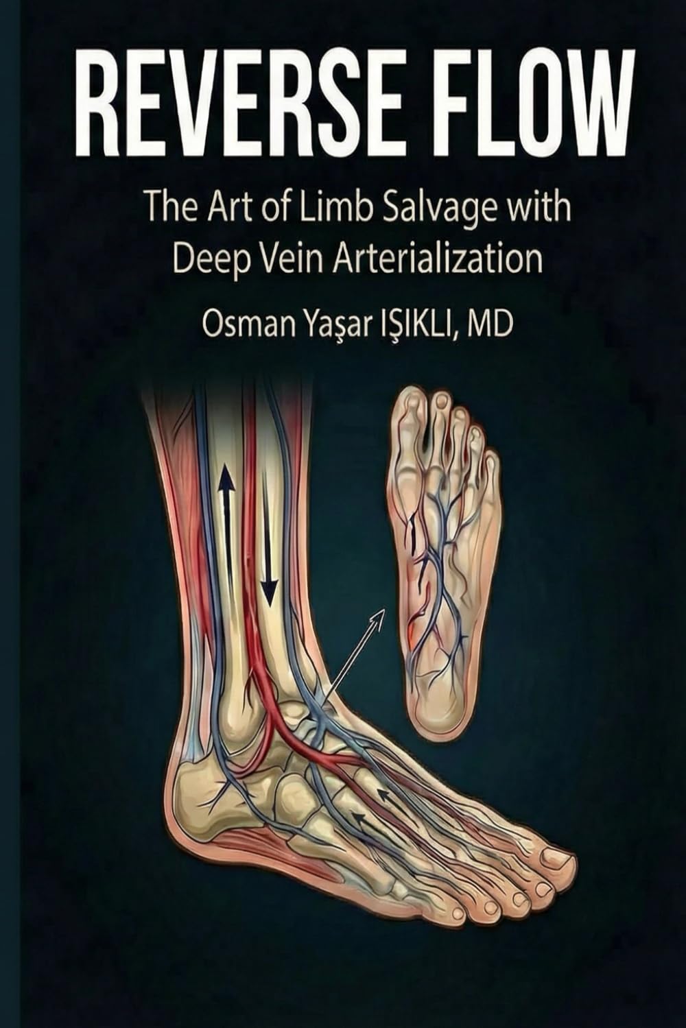 REVERSE FLOW: The Art of Limb Salvage with Deep Vein Arterialization