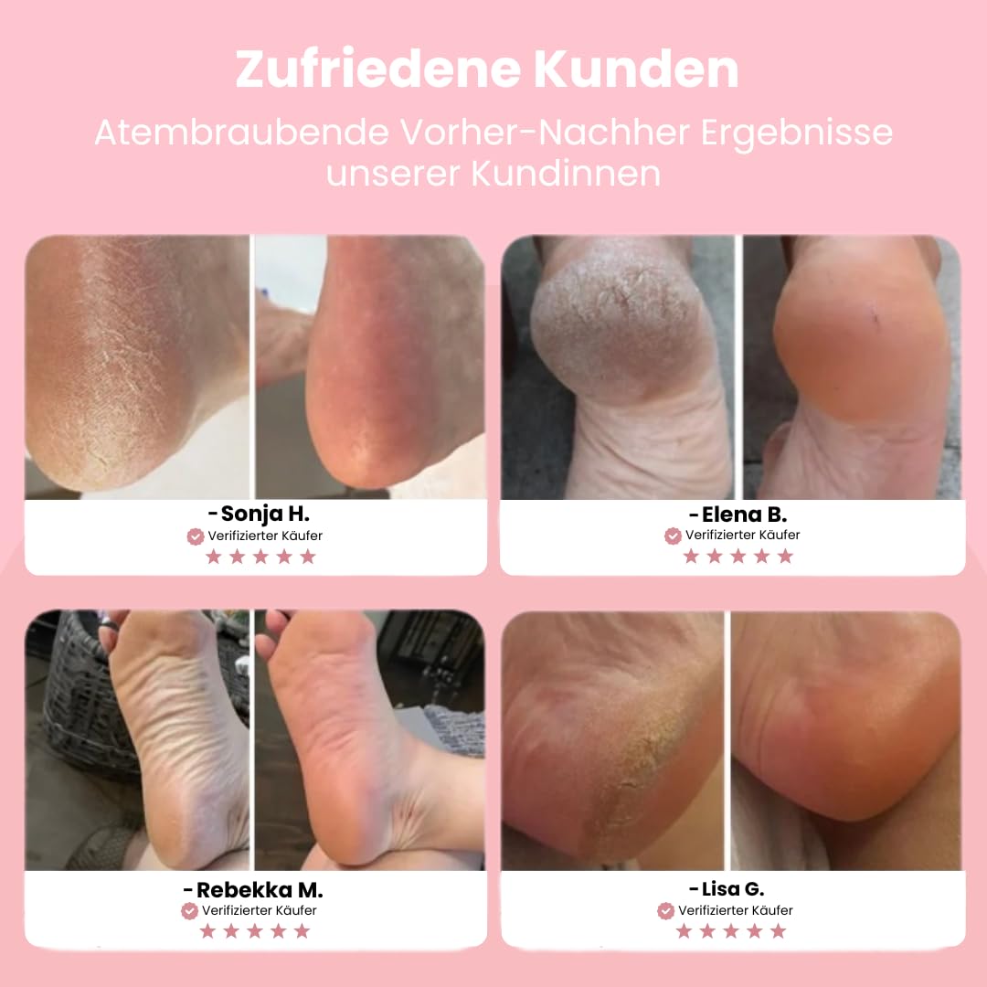 vera beauty Luva Pro - für seidig glatte Füße Motorisierter Hornhautentferner mit einstellbarer Geschwindigkeit, Ersatzpads für weiche Füße und effektive Pflege bei rissiger Haut.