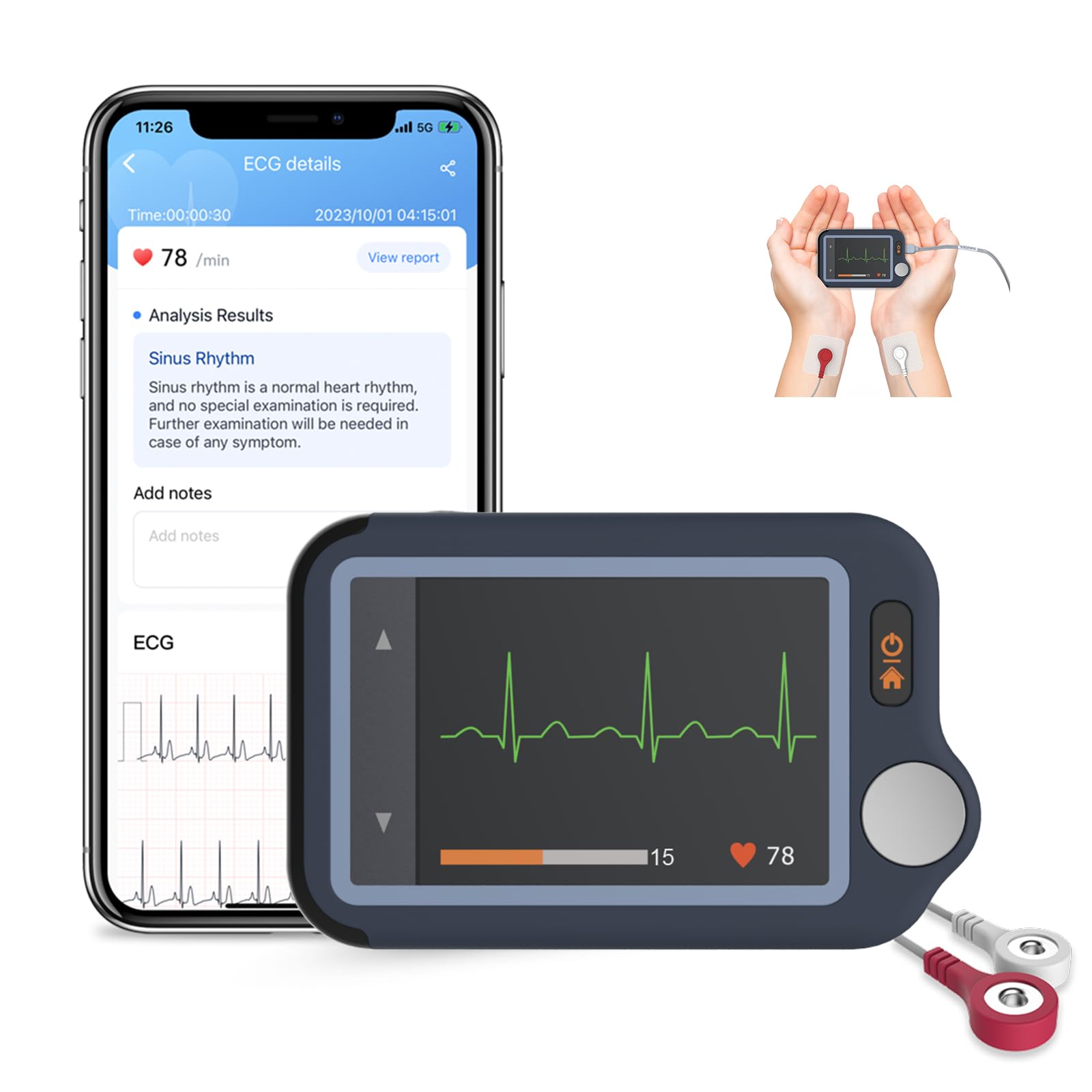 CheckMe Plus Monitor ECG per Uso Domestico,Funzione di Analisi ECG,30s/60s/5min ECG Portatile con Visualizzazione in Tempo Reale, Registra Prima, Carica Dopo, Memoria Illimitata (Smartphone/PC)