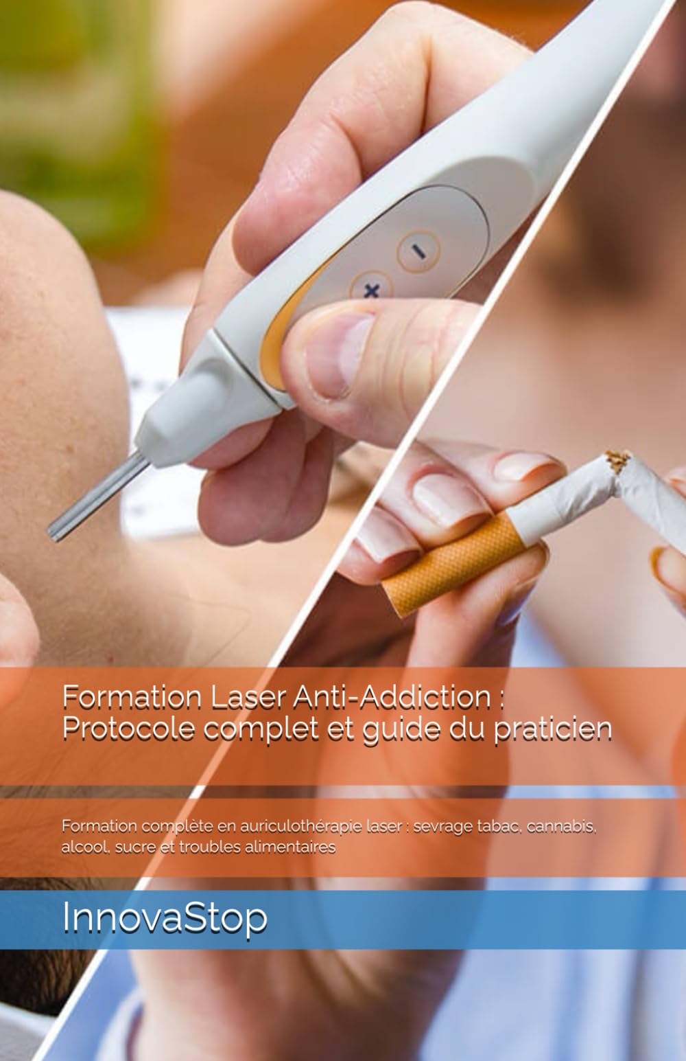 Formation Laser Anti-Addiction : Protocole complet et guide du praticien: Formation complète en auriculothérapie laser : sevrage tabac, cannabis, alcool, sucre et troubles alimentaires