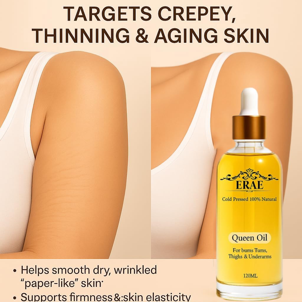 ERAE Queen Body Oil – Miscela botanica pressata a freddo per idratare e rassodare la pelle, olio idratante per il corpo leggero ad assorbimento rapido per braccia, gambe e stomaco