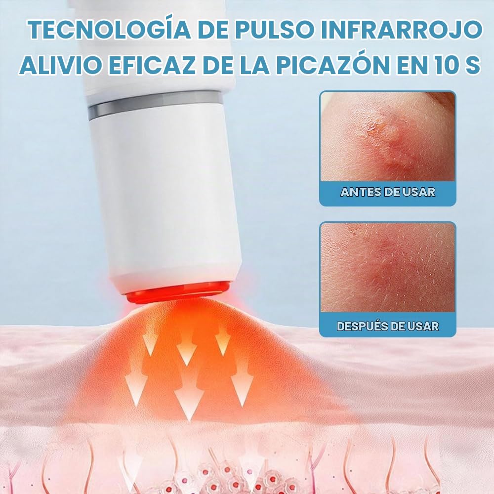 Insect Bites and Bites Treatment Devic, Afenau Picaduras Mosquitos Alivio USB-C, Lapiz Picaduras Mosquitos sin Productos Químicos, Tratador electrónico de picaduras para uso Doméstico