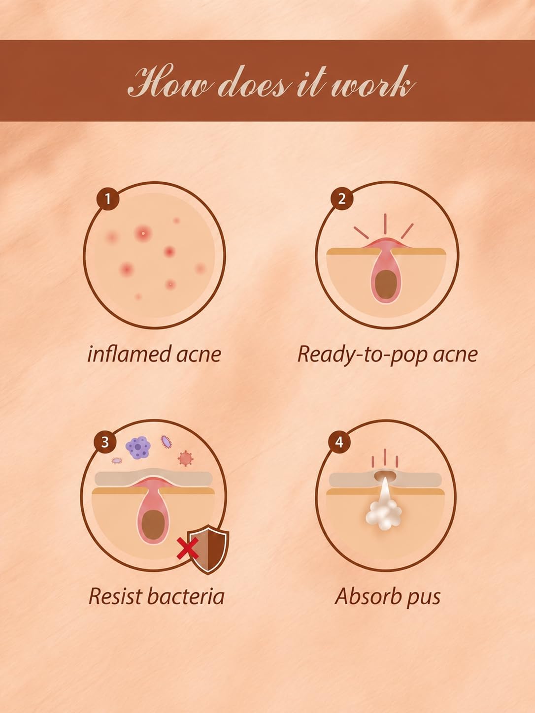 72 Patches Acne Hydrocolloid Spot Patches, Best Pimple Patches for Acne with 0.5% Salicylic Acid, Hydrocolloid Acne Patches for Face, Ultra-Thin Overnight Spot Treatment