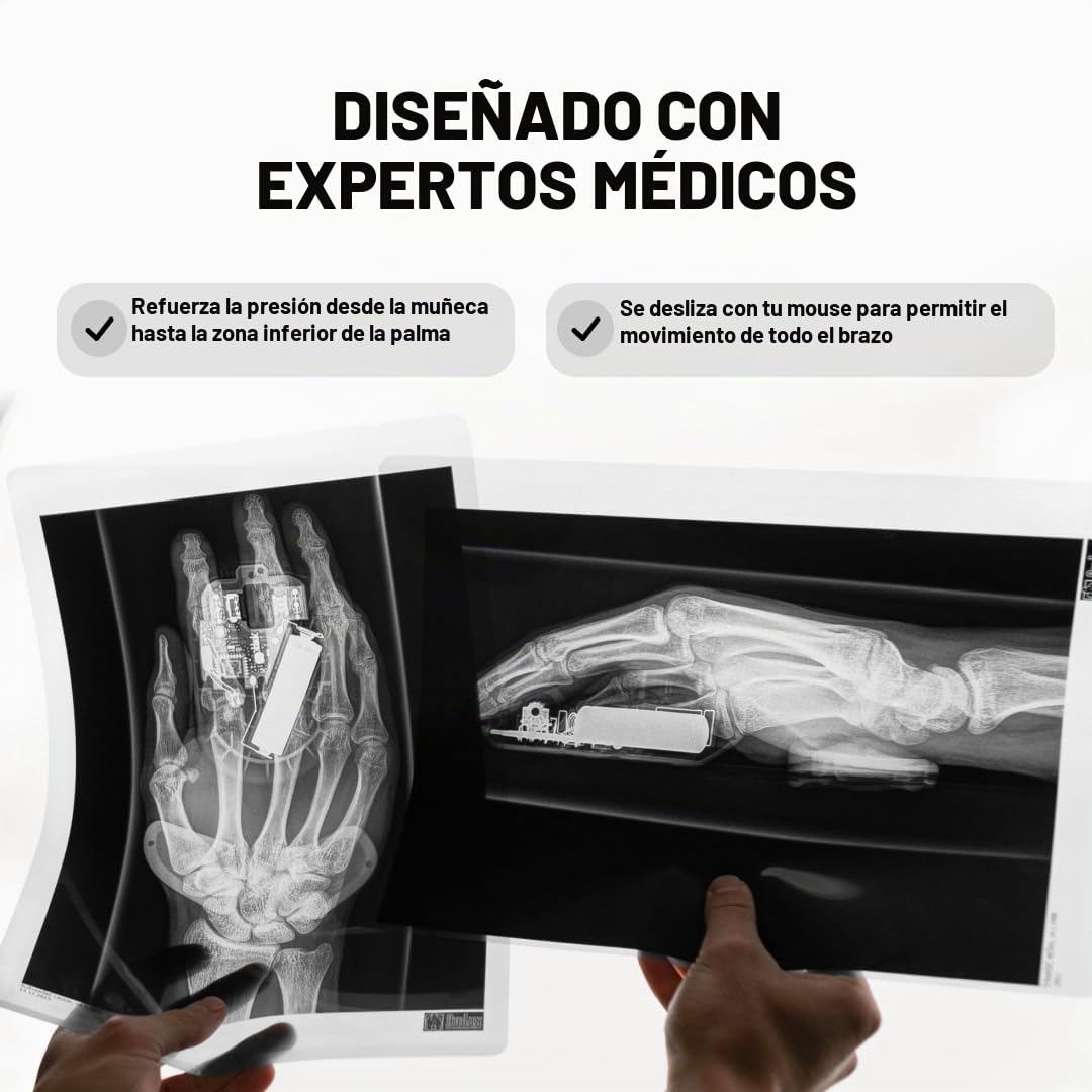 DELTAHUB Carpio 2.0 Reposamuñecas ergonómico para ratón, para diestros, túnel carpiano, alivio del dolor, antifatiga, fácil deslizamiento, elegante, PC de oficina, portátil, juegos, pequeño, negro