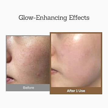 MEDITHERAPY Rice Wash-Off Mask - Korean Glass Skin Face Mask Skincare - Hydrating Rice Clay Mask - Natural Exfoliants Gently Improve Skin Texture, Even Skin Tone, and Restore Radiant Glow, 6.76 fl.