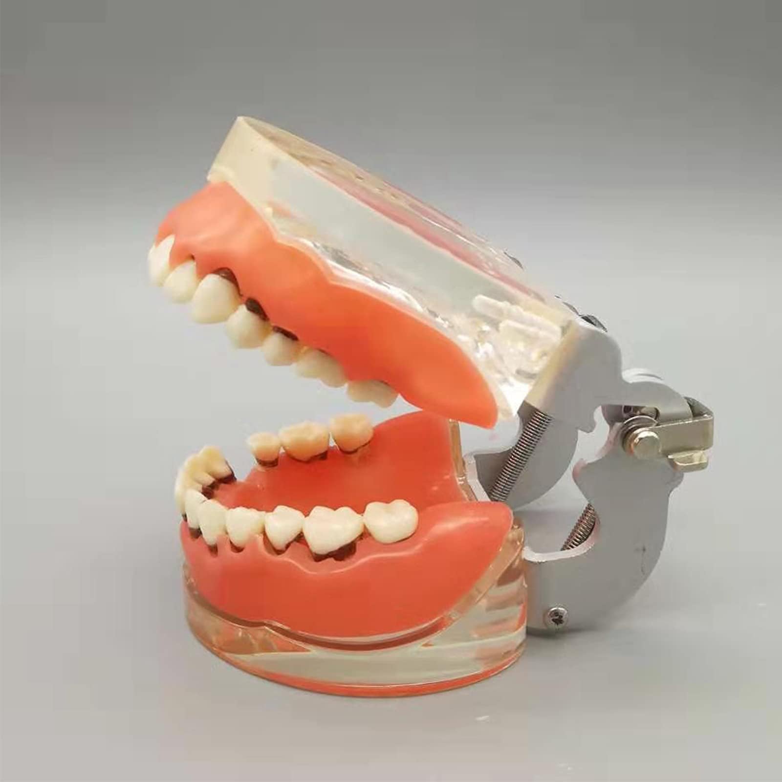 YZILXY Dental Study Transparent Adult Pathological Periodontal Disease Teeth Model Detachable Model For Doctor-patient Communication