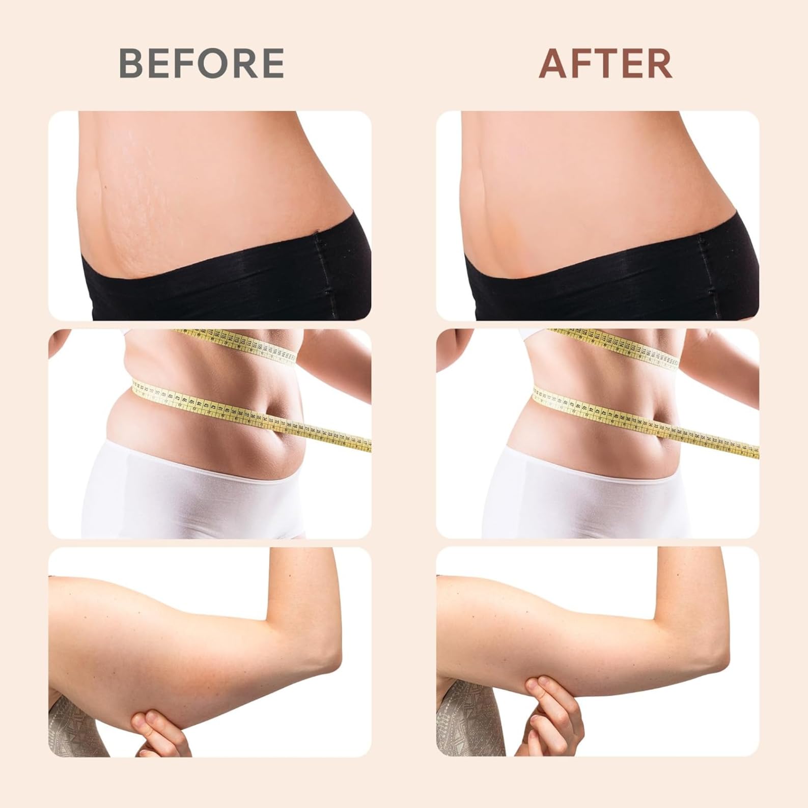 Masaje Anti Celulitis Masajeador, Aparato Anti Celulitis, 3 en 1 Masajeador Anticelulítico Multifuncionales Portátiles Para el Tamaño, Vientre, Nalgas, Brazosy Piernas, Unise, Hombres para Levantar - 4