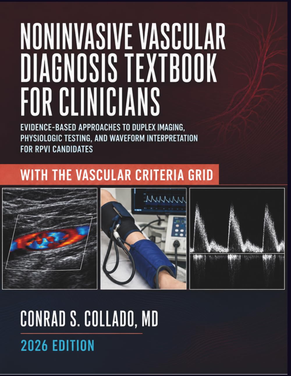 Noninvasive Vascular Diagnosis Textbook for Clinicians: Evidence-Based Approaches to Duplex Imaging, Physiologic Testing, and Waveform Interpretation for Rpvi Candidates