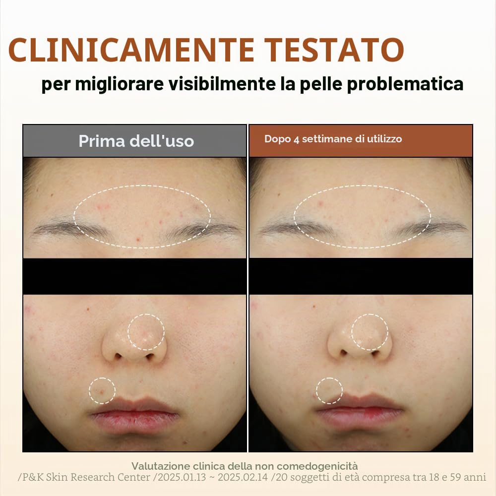 BY WISHTREND Acido Mandelico 5% Acqua di preparazione della pelle, esfoliante delicato per la pelle del viso, ideale per pelli sensibili | Aiuta i pori ostruiti e la pigmentazione (4,1 Fl Oz (1))