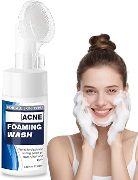 Acne Foam Wash, Gentle Deep Pore Cleansing Face Wash for Women and Men   Mild Foaming Cleanser with Exfoliating Power, Refreshing Facial Wash to Remove Impurities & Unclog Pores