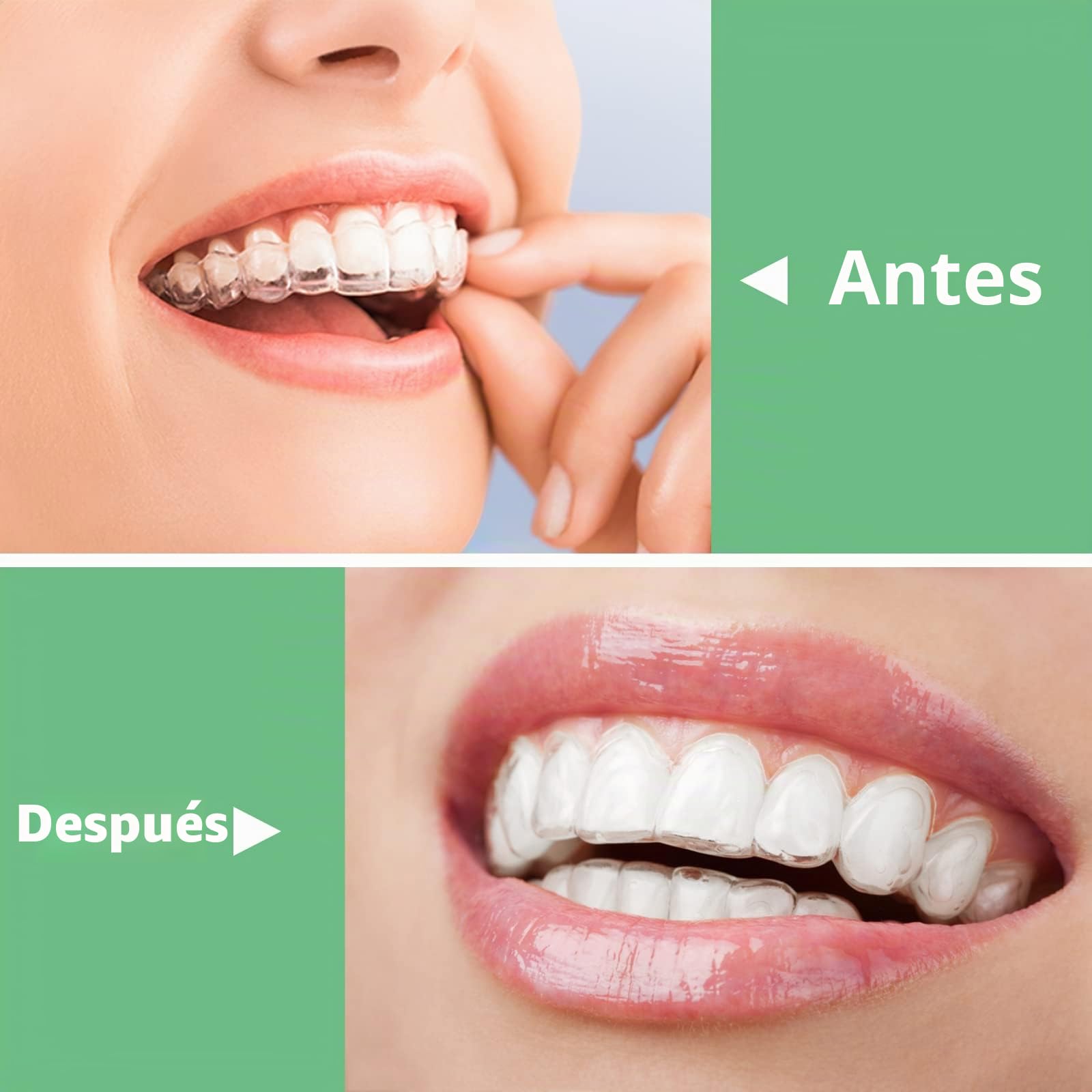 BVN Aligner Chewies, 20 Piezas Alineadores Chewies con 2 Piezas Herramientas de Extracción de Alineador, Alineadoras Asiento, Masticadores Alineadoras, Alineador Chewies Masticadores, Verde
