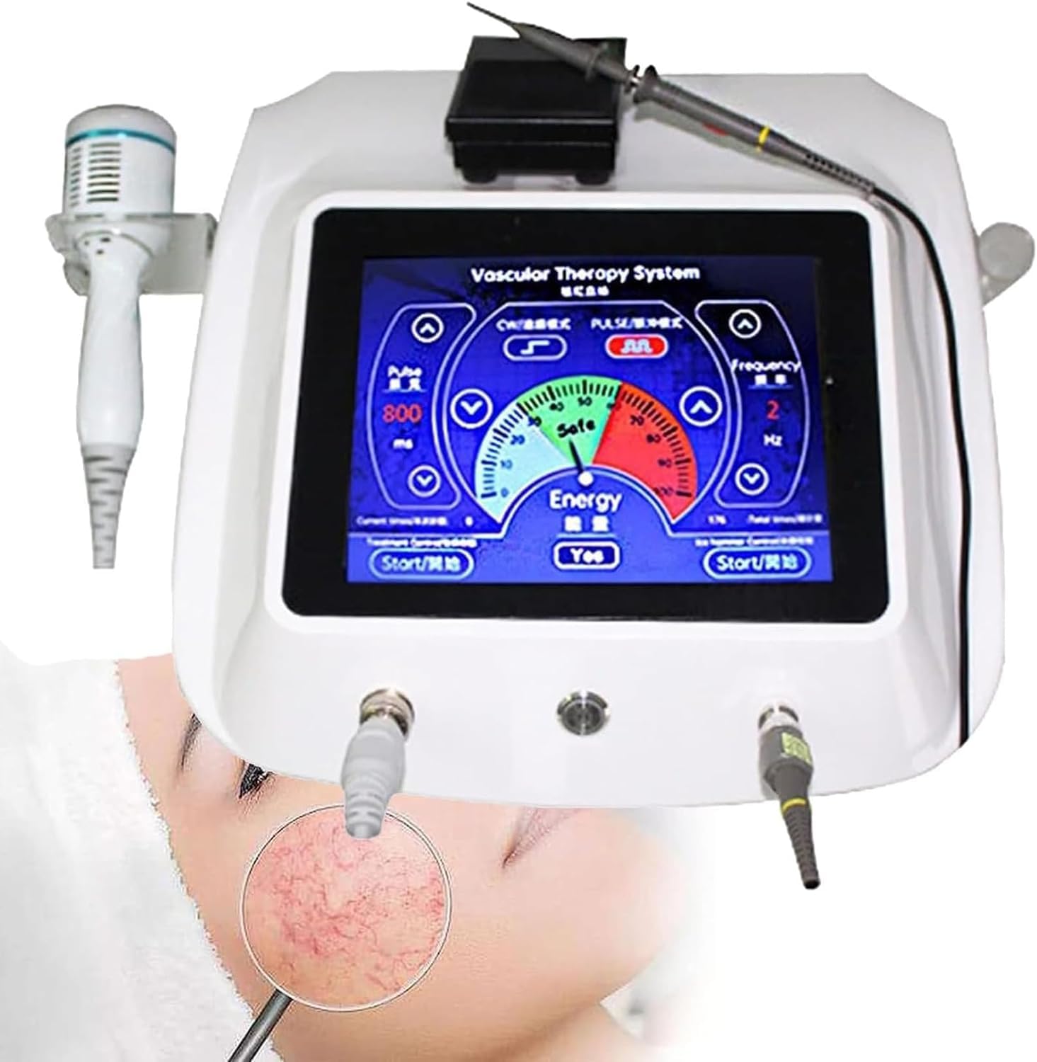 HDCCDM Remove Facial Thread Veins Red Blood Vessel Spots,High Frequency Spider Veins Removal Device,Vascular Removal Beauty Equipment Professional Facial Treatment Beauty Device
