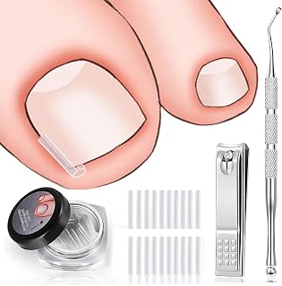 Ingrown Toenail Treatment Includes 60 PCS of Ingrown Toenail Corrector Strips, Ingrown Toenail Lifter And Nail Clipper, Professional Ingrown Toenail Correction Tool