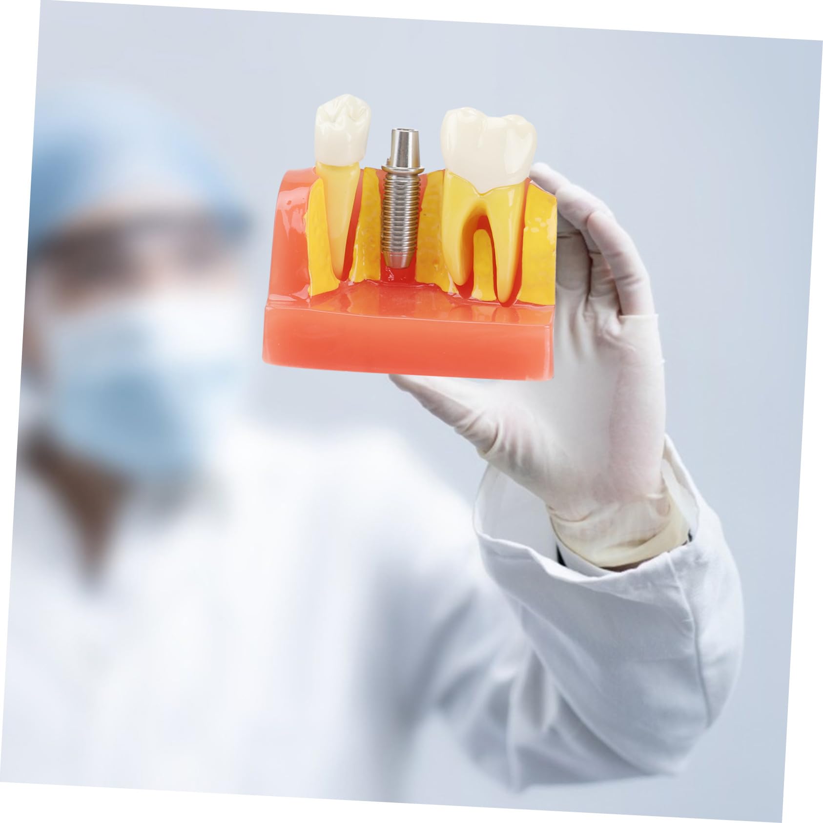 Cabilock 4-faches Zahnmodell für Lehre und Mundpflege mit Oral Demonstrationsfunktion für Unterricht und Patientenkommunikation