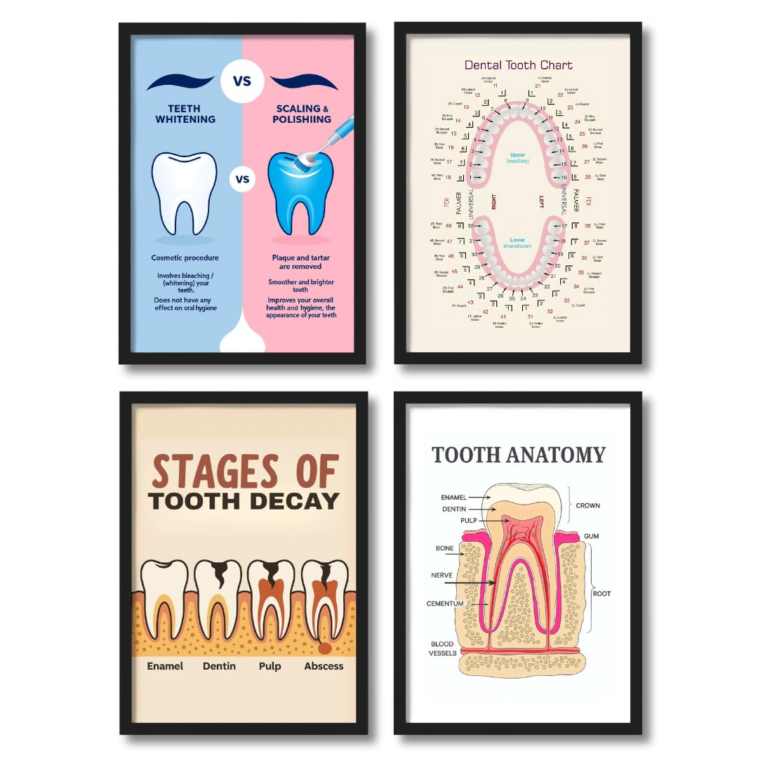 ArtAction Dental Clinic Wall Frame Poster Set of 4 | Educational Tooth Anatomy & Decay Charts for Dental Office, Clinic | A4 Size | Dental Tooth Chart Wall Art | Gifting for Dentists, Students-image-28