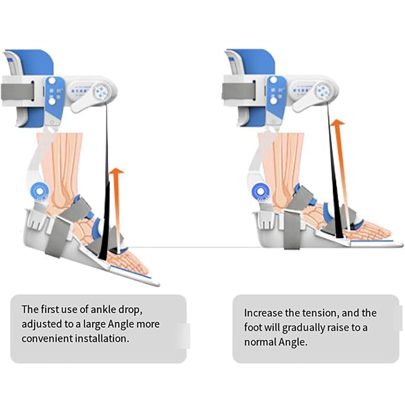 Entrenador Rehabilitación Tobillo, Equipo Ortopédico Tobillo Con Placa Angular, Fuerza Corrección Ajustable 75° Y Estructura Mecánicamente Estable, Diseño Cómodo Todo Incluido,para Caída Del Pie