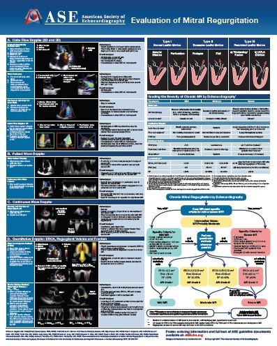 Evaluation of Mitral Regurgitation Poster: American Society of ...