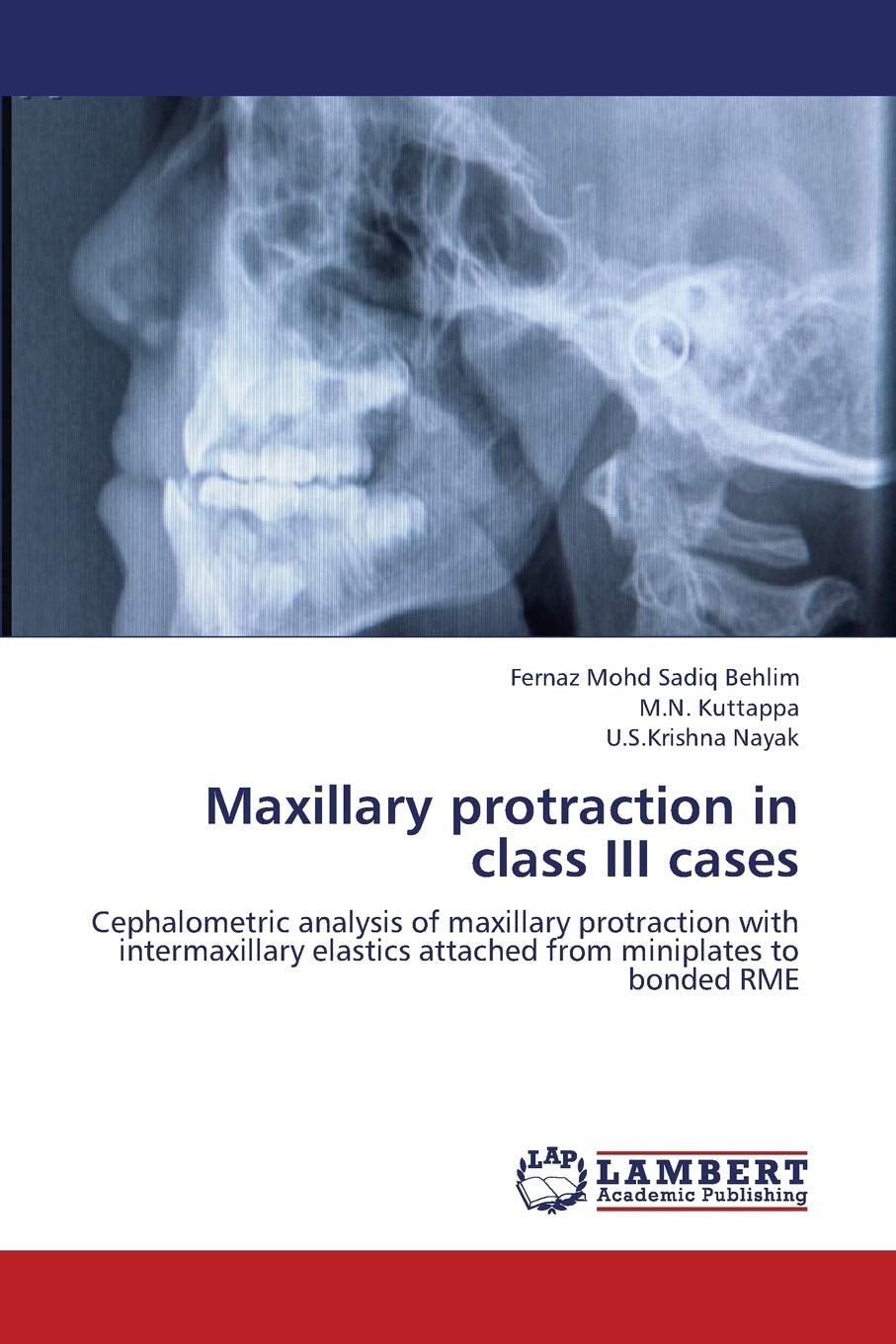 Buy Maxillary protraction in class III cases: Cephalometric analysis of ...