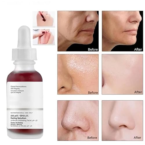 Miniatura 4 de Peeling Solution 30ML, AHA 30% + BHA 2% Anti Acne Serum For Face, 1 Floz Exfoliating Facial Serum, Reduces Pore Congestion & Fine Lines, Fighting