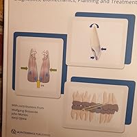 Aligner Orthodontics: Diagnostics, Biomechanics, Planning and