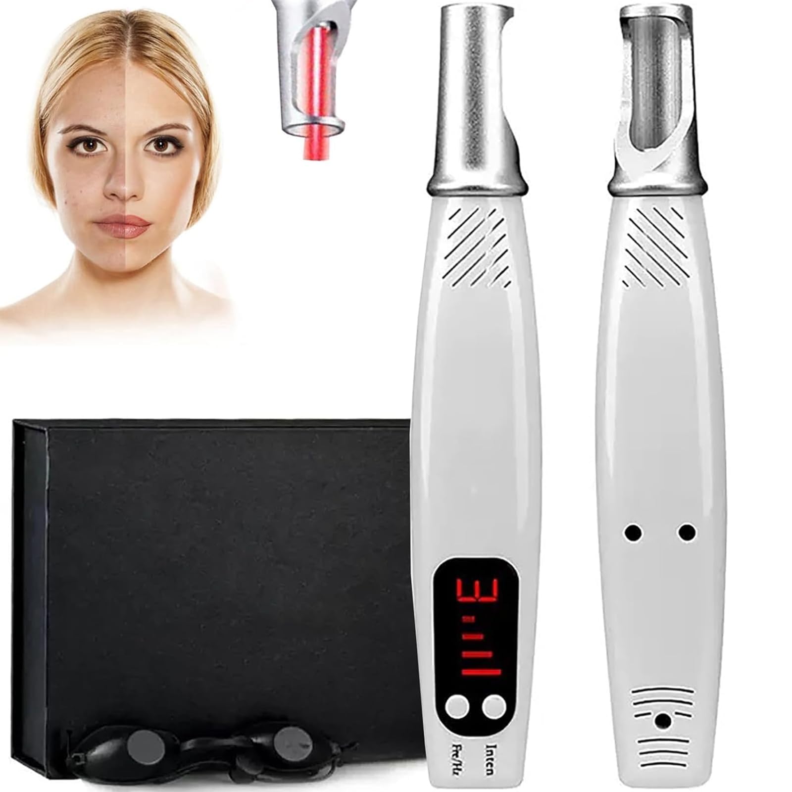 Stylo picoseconde plasma pour éliminer les grains de beauté