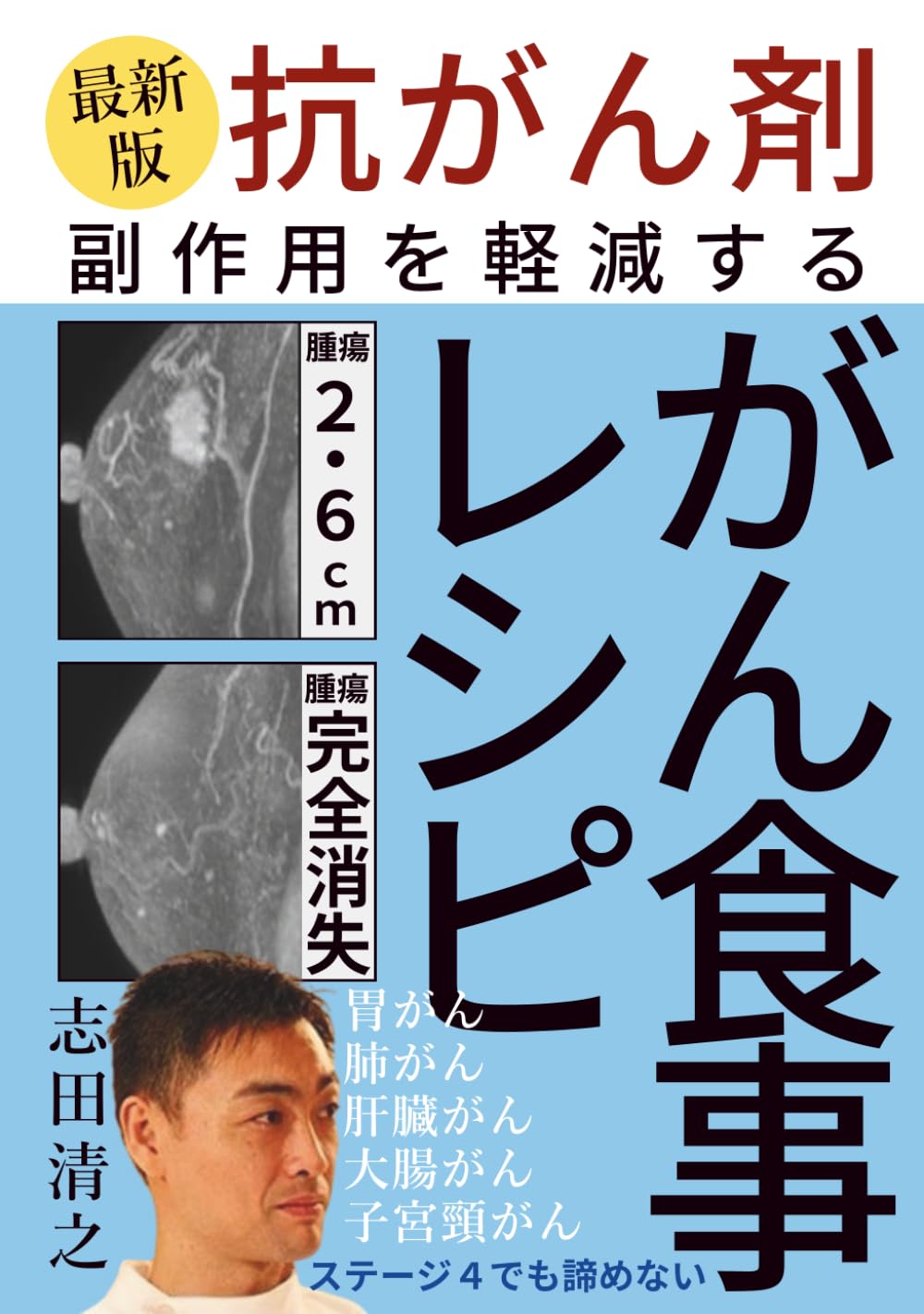 がん食事レシピ 抗がん剤の副作用を軽減する癌食事レシピ【がん免疫