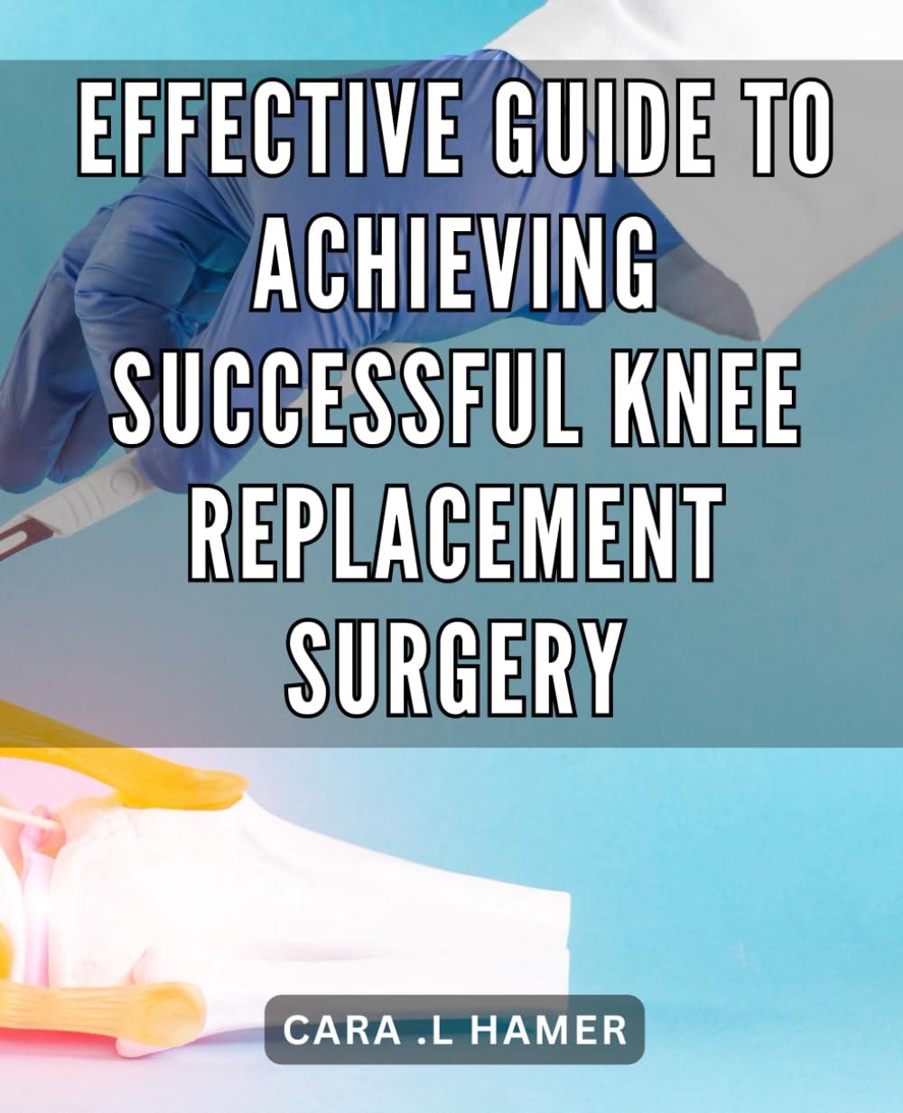 Effective Guide to Achieving Successful Knee Replacement Surgery The