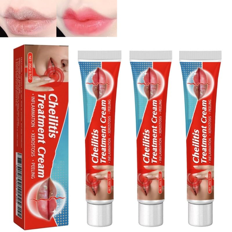 Lip Lightening Cream, 20g Lip Balm Moisturizing, Lightening balm for Men and Women, 3pcs