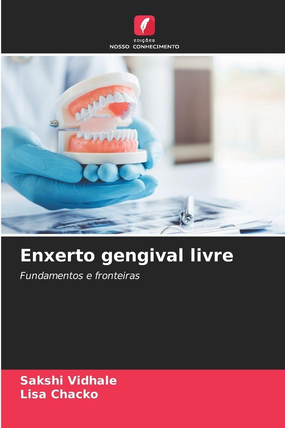 Enxerto gengival livre: Fundamentos e fronteiras