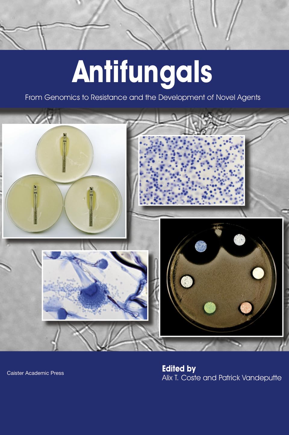 Buy Antifungals: From Genomics to Resistance and the Development of Novel Agents — BookShops.in