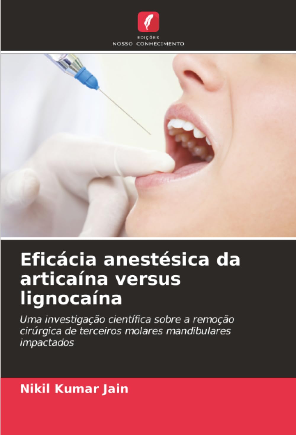 Eficácia anestésica da articaína versus lignocaína: Uma investigação científica sobre a remoção cirúrgica de terceiros molares mandibulares impactados