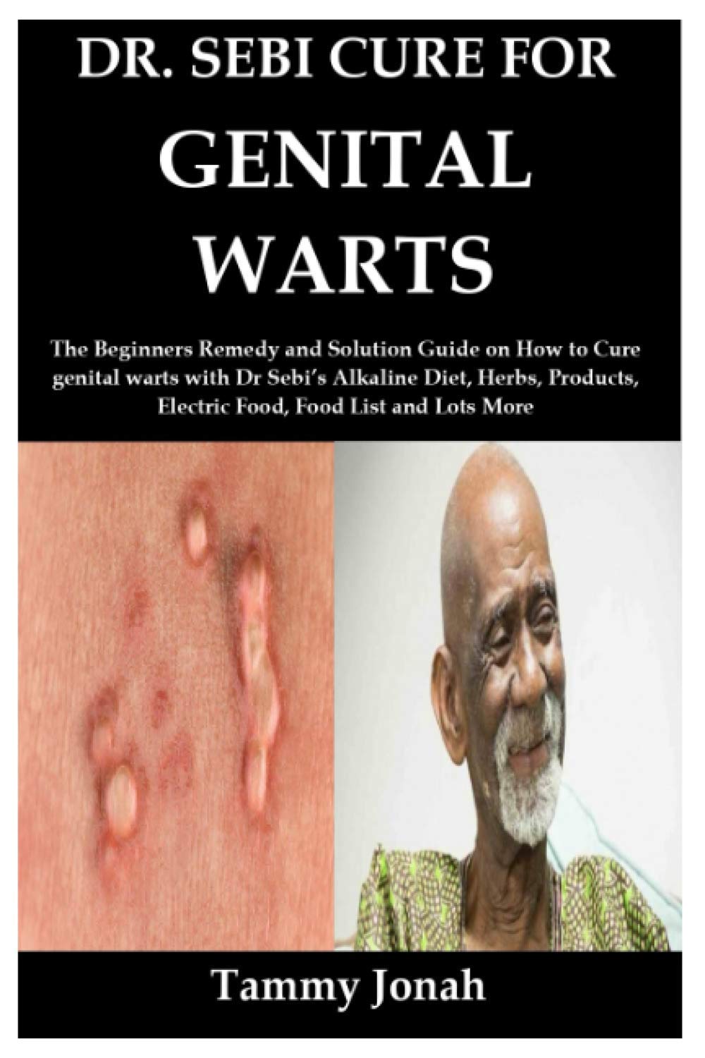 DR. SEBI CURE FOR GENITAL WARTS The Beginners Remedy and Solution