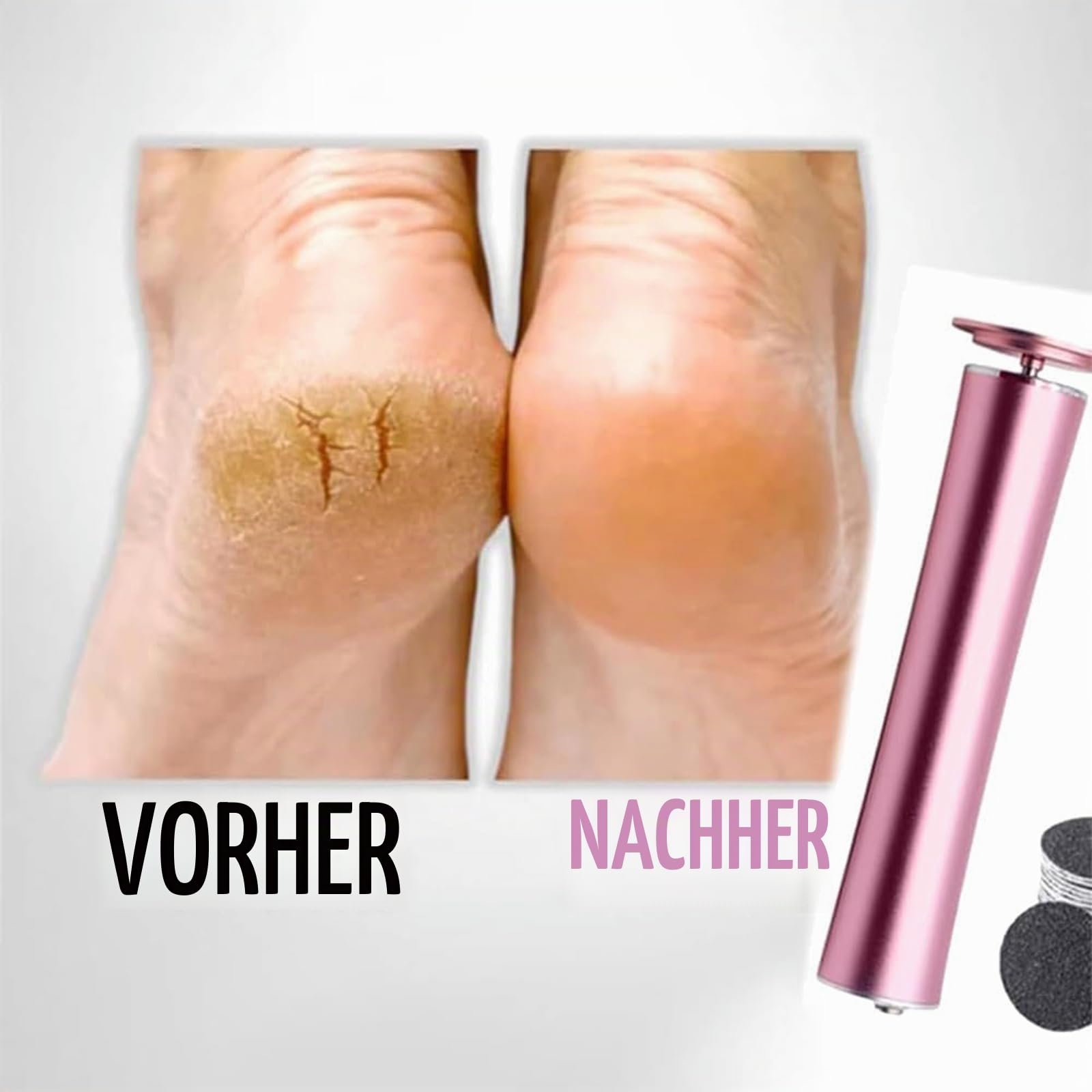 Dermaglide Hornhaut Entferner, Dermaglite Pro Hornhautentferner Für Zuhause, Derma Glide Hornhautentferner, Fußfeile Elektrisch With 120 Pieces Sandpaper Pads, Für Rissige, Trockene Hornhaut (Schwarz)