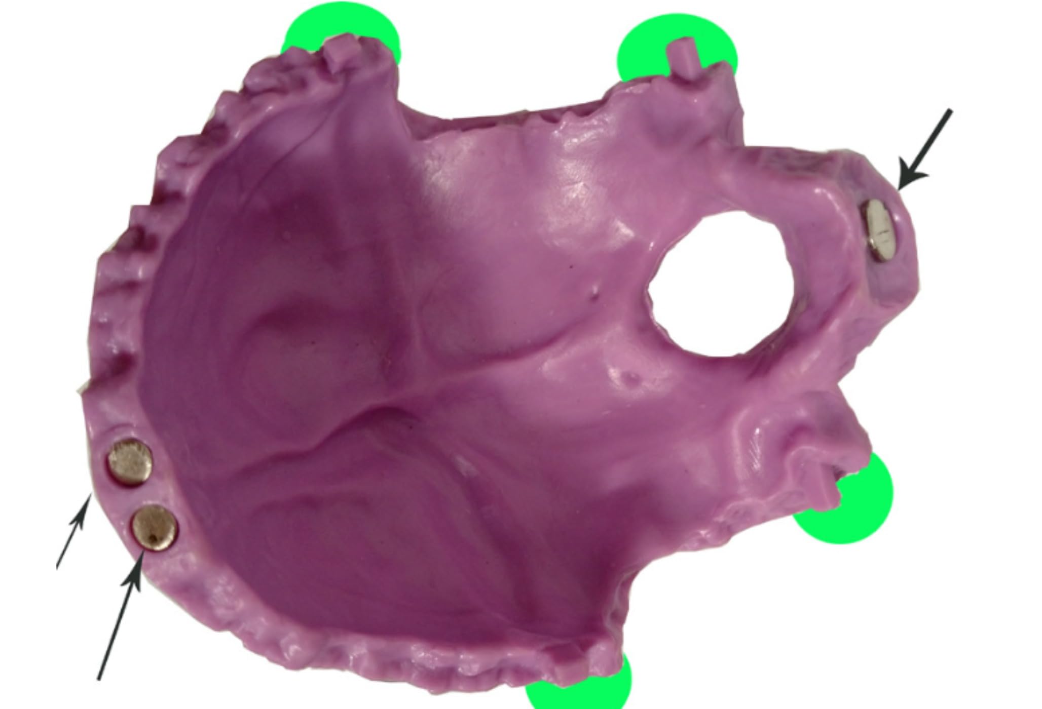 顎関節模型 【公式通販】