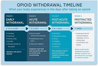Opioid Withdrawal Timeline Poster Symptom Stages Reference Canvas Painting for Bedroom Living Room Decor 12x08inch(30x20cm) Unframe-style