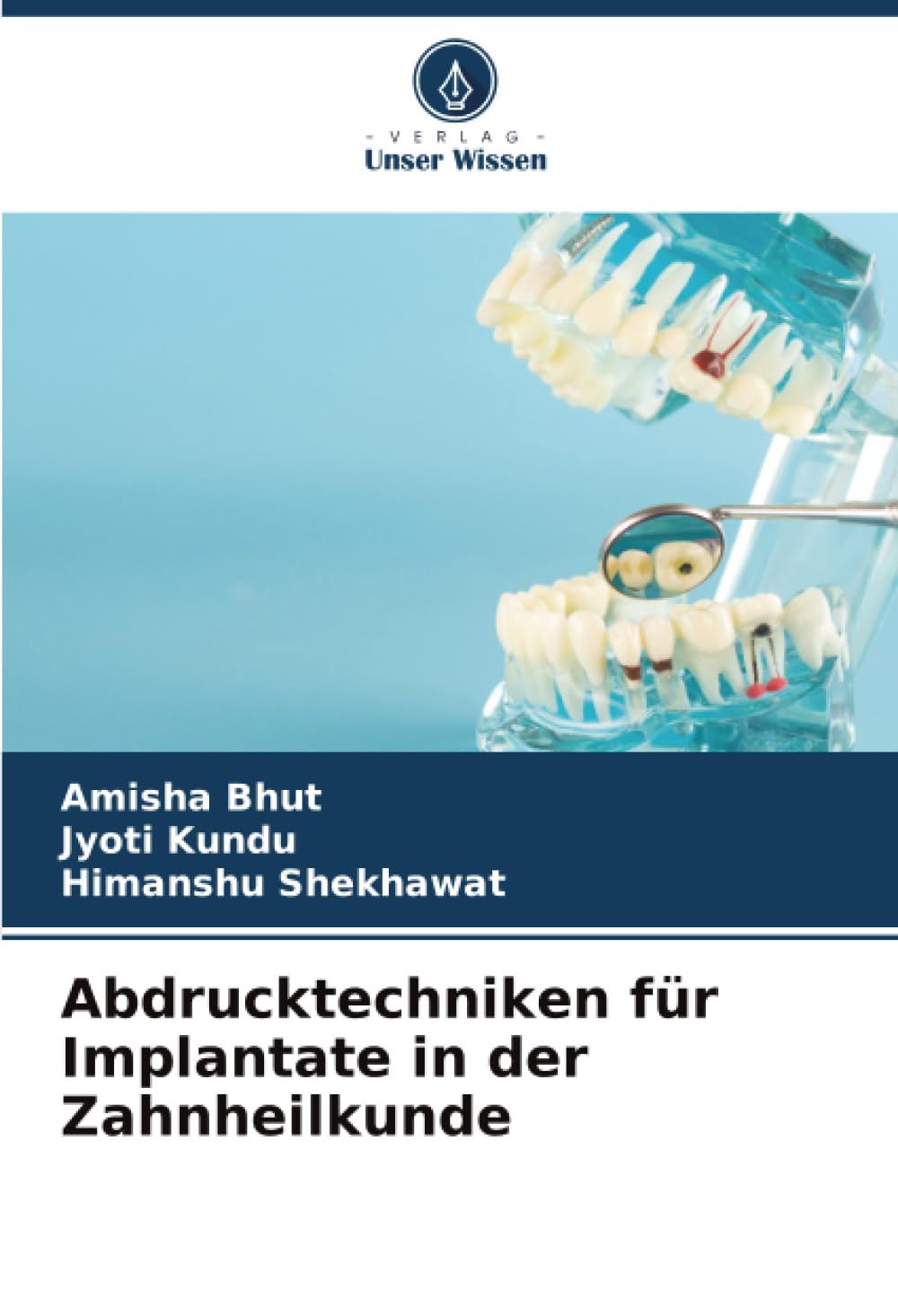 Abdrucktechniken für Implantate in der Zahnheilkunde