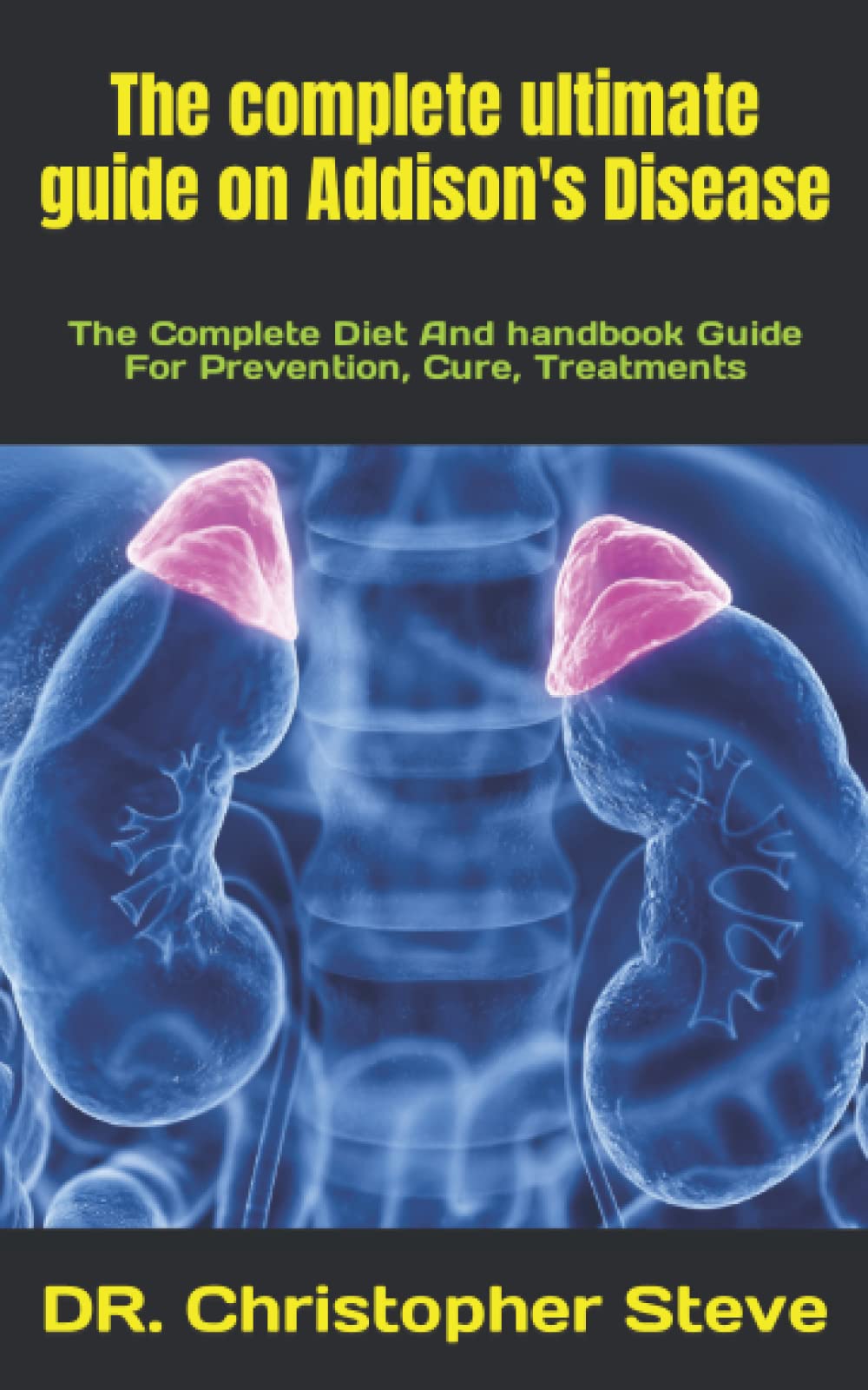 Buy The complete ultimate guide on Addison's Disease. The Complete