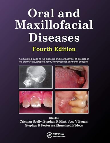Oral and Maxillofacial Diseases: An Illustrated Guide to the Diagnosis and Management of Diseases of the Oral Mucosa, Gingivae, Teeth, Salivary Glands, Jaw Bones and Joints