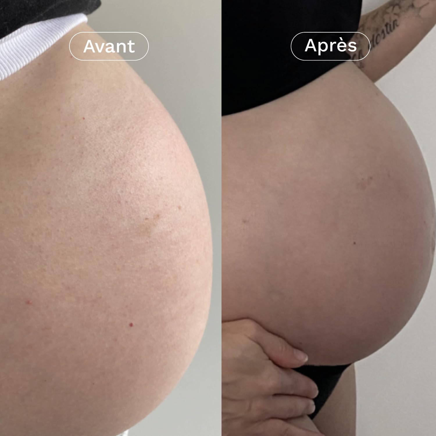 OMUM - La Surdouée Duo Crème et Huile - Prévention vergetures - Protège, régénère la peau, prévient la formation des vergetures - Compatible grossesse dès 1er mois - Vegan - 150 ml et 100 ml