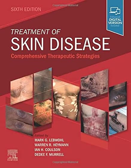 Treatment of skin disease:comprehensive therapeutic strateg