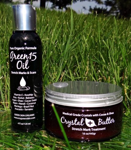 Best STRETCH MARK Complete Solution Kit- Medical grade microdermabrasion crystals mixed with Raw Cocoa Butter +organic 15 natural oils blend Stretch Mark COMPLETE KIT Microdermabrasion Crystal Butter & Green15 Oil shown to prevent and remove old stretch marks, microdermabrasion crystals exfoliate dead scars and stretch marks, stretch mark oil nourishes and repairs broken skin