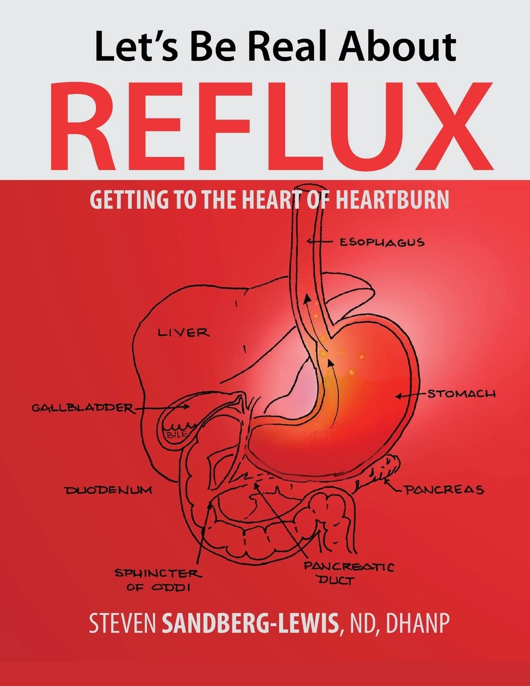 Let's Be Real About Reflux, Getting To The Heart of Heartburn Paperback – 31 March 2023