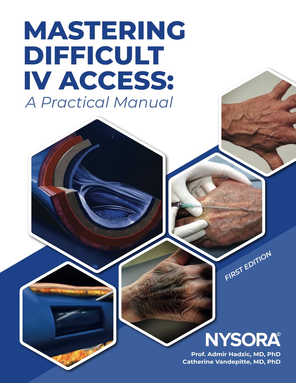 Mastering Difficult IV Access - a Practical Manual: First Edition