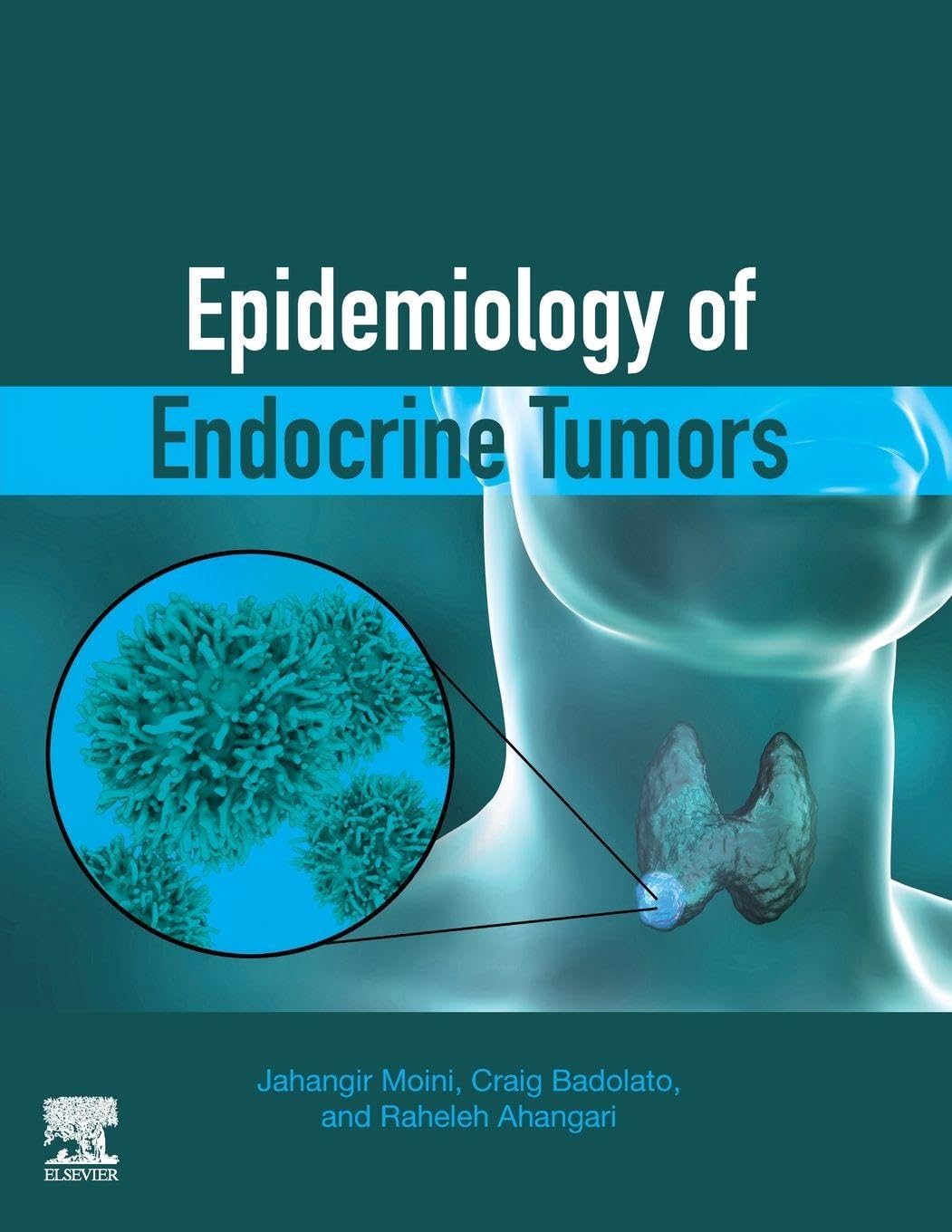 Epidemiology of Endocrine Tumors